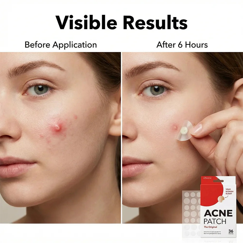 Invisible Acne Magic Patches